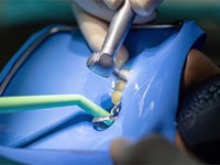 5 señales de alarma que indican que podrías necesitar a nuestro dentista en Vigo para una endodoncia