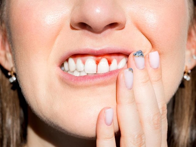 ¿Es normal sangrar al cepillarse los dientes?