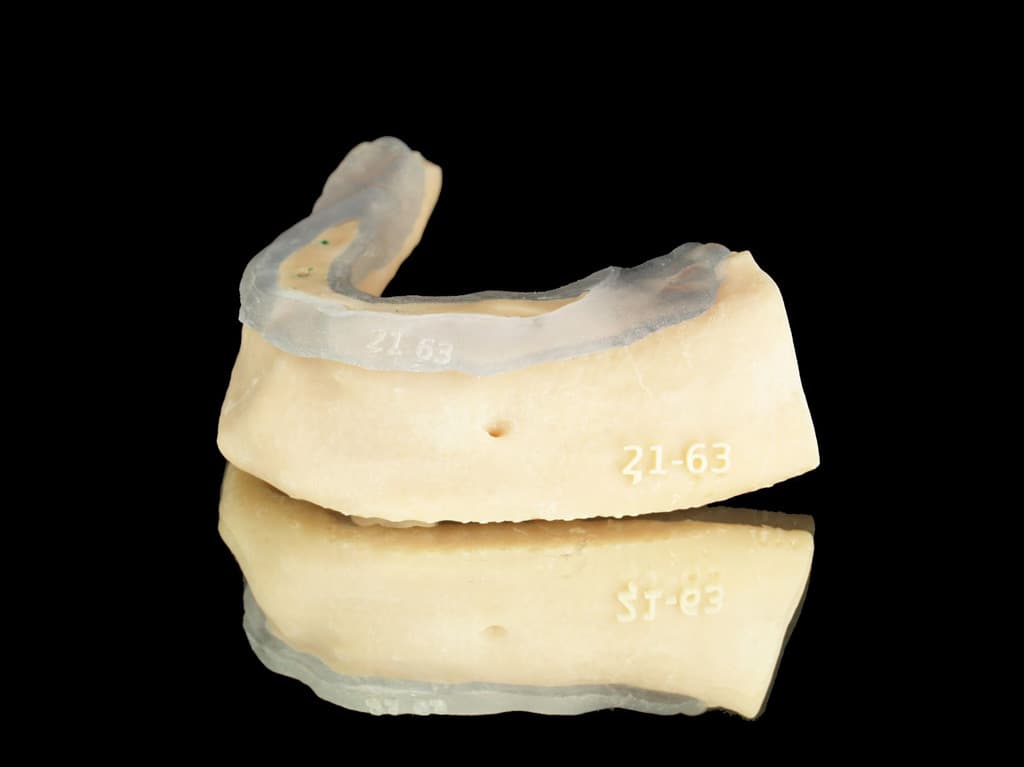 Implantes de dientes en Vigo