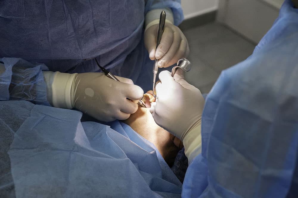 Implantes dentales en Vigo