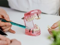 ¿Implante dental o puente fijo? Analizamos cuál te conviene más